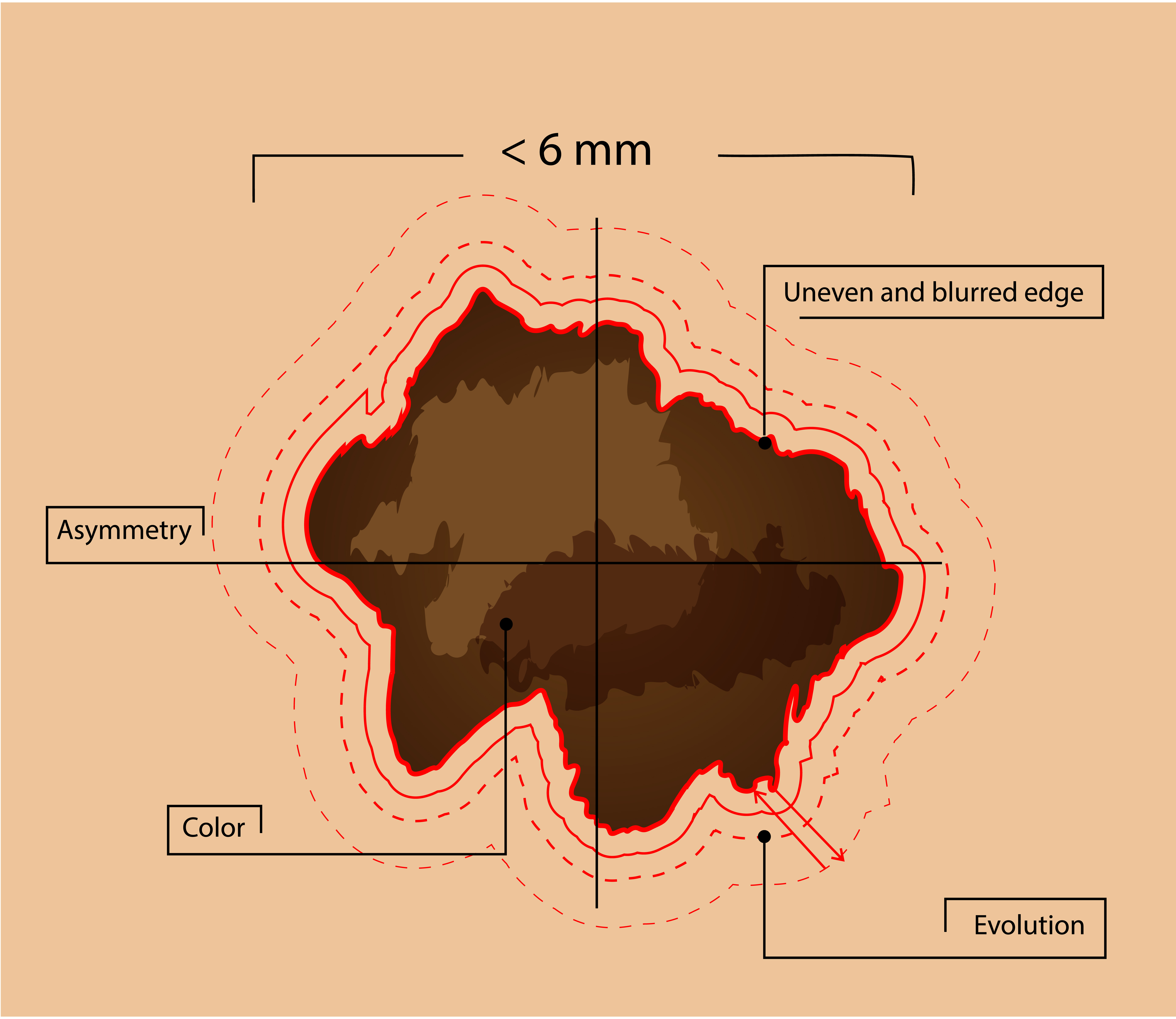 UV Radiation  NCEH Environmental Health Features