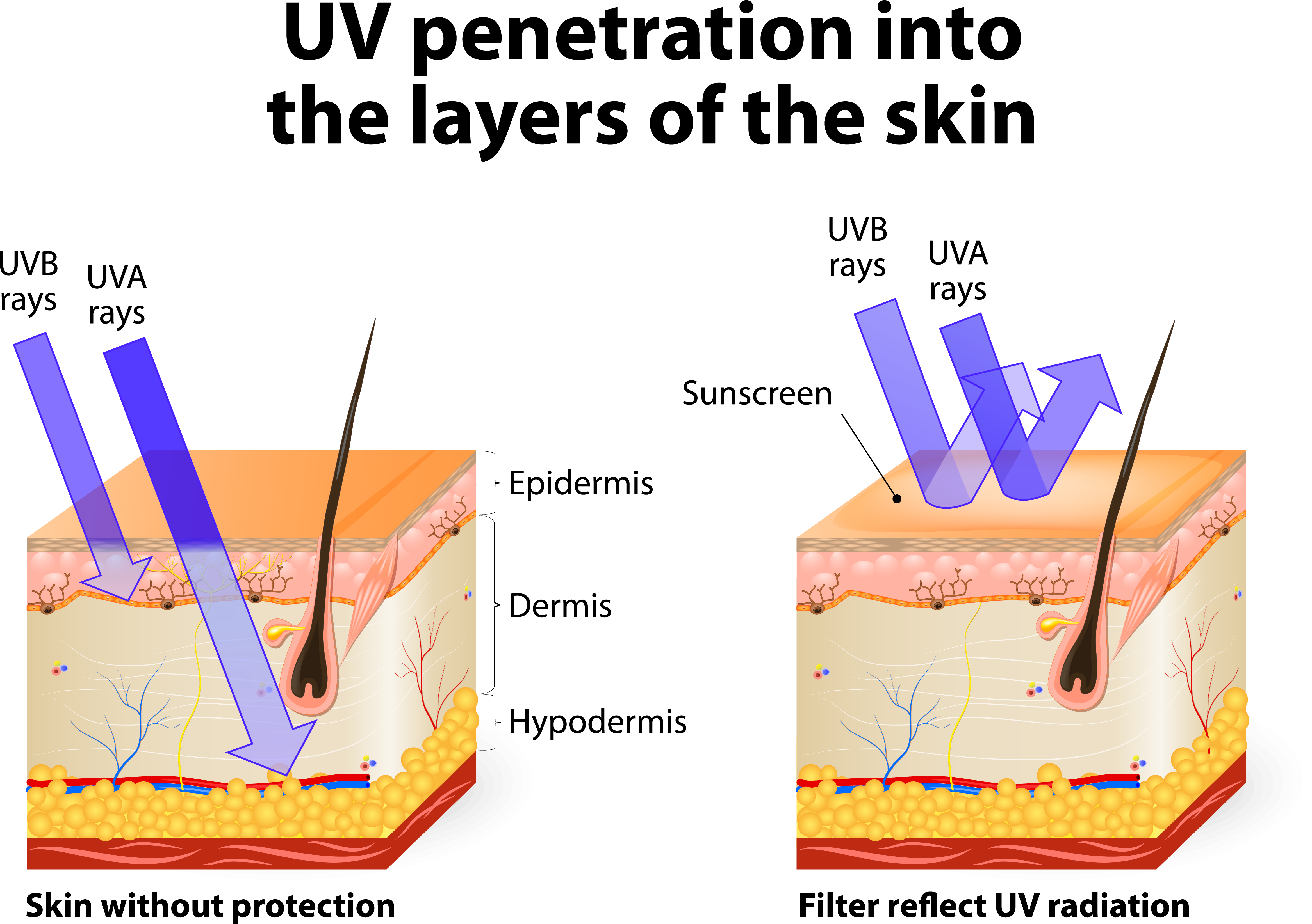 UV Radiation  NCEH Environmental Health Features